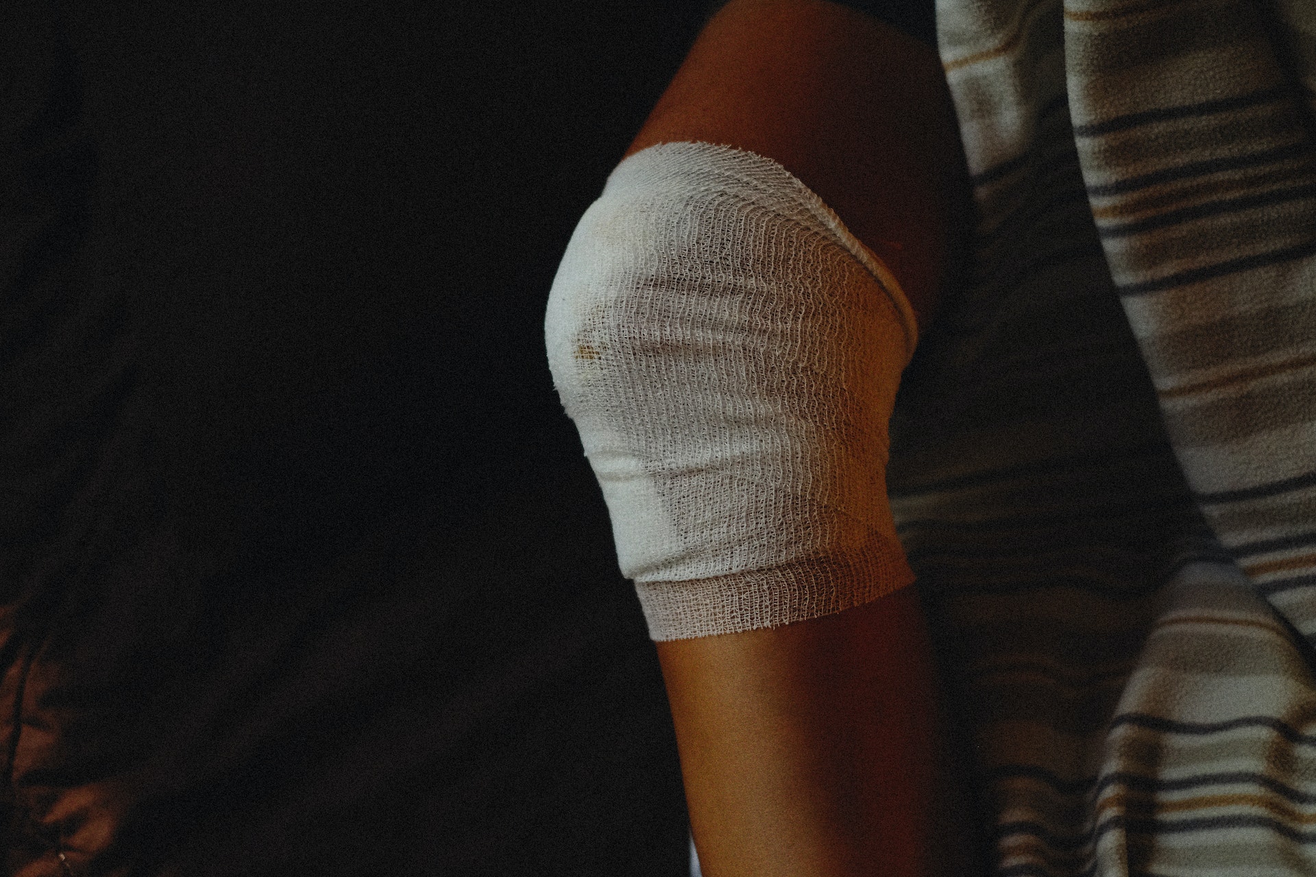 Joint injury